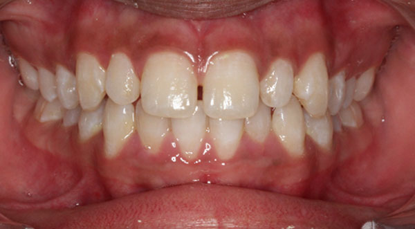 Orthodontist bangalore